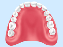総入れ歯